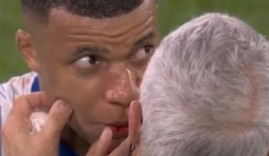 Mbappé fratura o nariz e deve desfalcar a França nos próximos jogos
